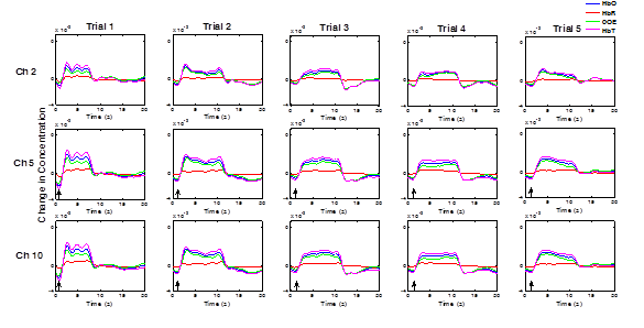 Time series (ΔHbO, ΔHbR, ΔHbT, ΔCOE) for 20 s after the stimulus for all 5 trials of the mental arithmetic task