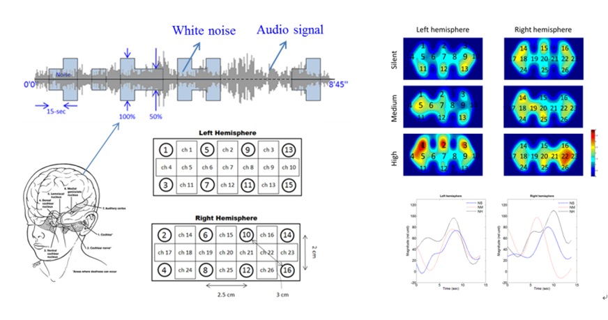 Experimental paradigm and results of audio cortex activation 
